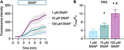 Tracking endothelium-dependent NO release in pressurized arteries